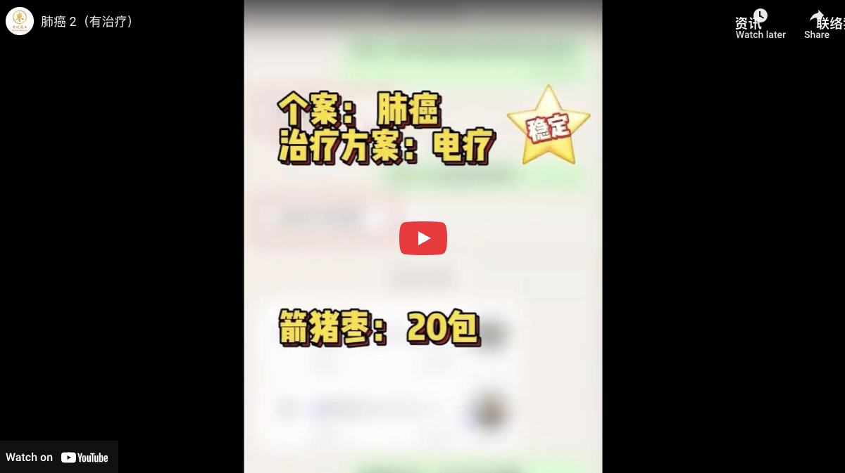 肺癌 2